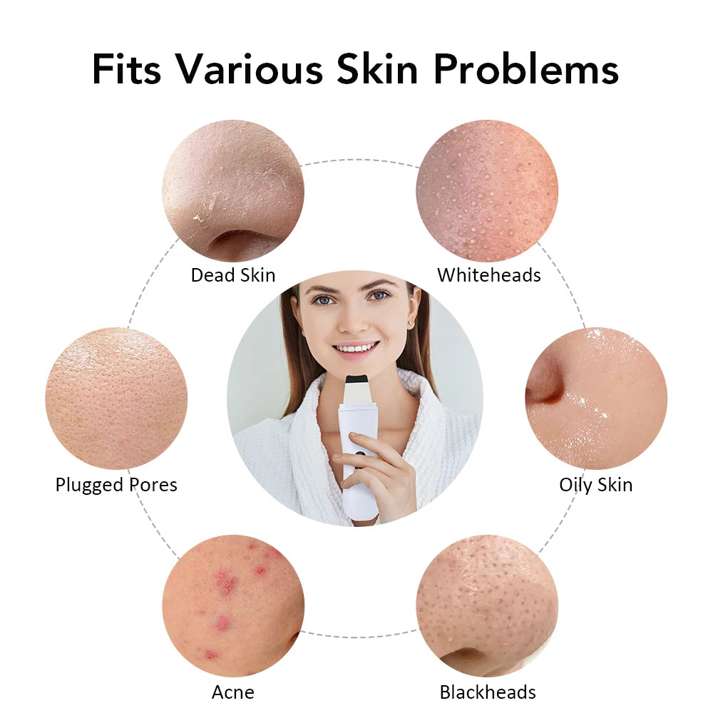 Ultrasonic Deep Cleansing Skin Tool